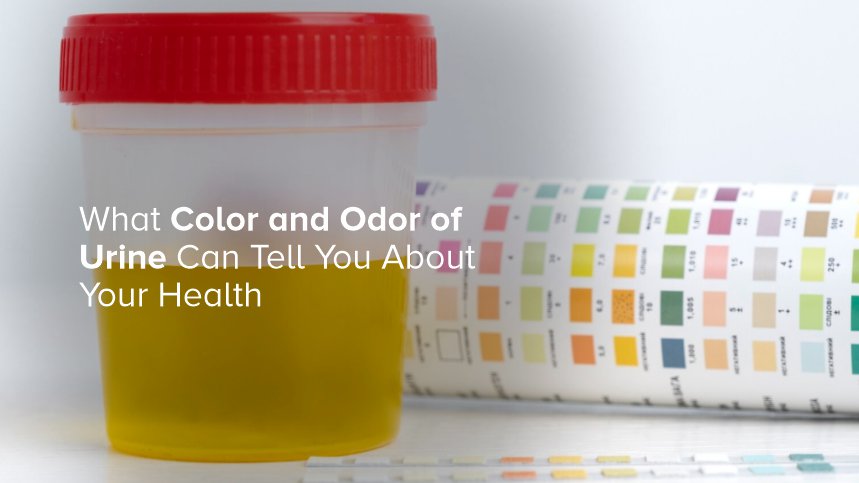 What Color and Odor of Urine Can Tell You About Your Health
